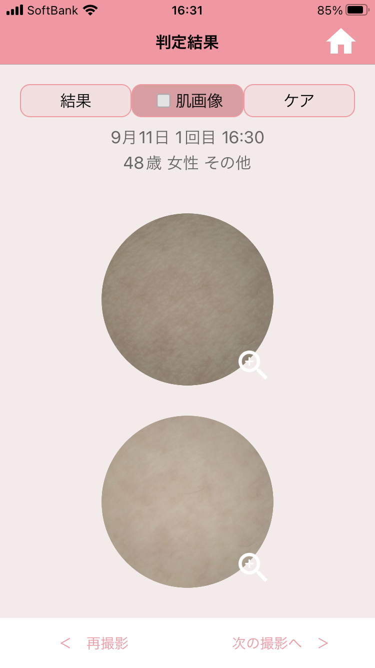 肌と解析画像